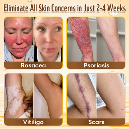 ✨HISKIN® Multi-Concern Skin Repair Cream ✨ (One powerful cream to repair inflammation, dryness, aging, pigmentation, and visible skin damage.)