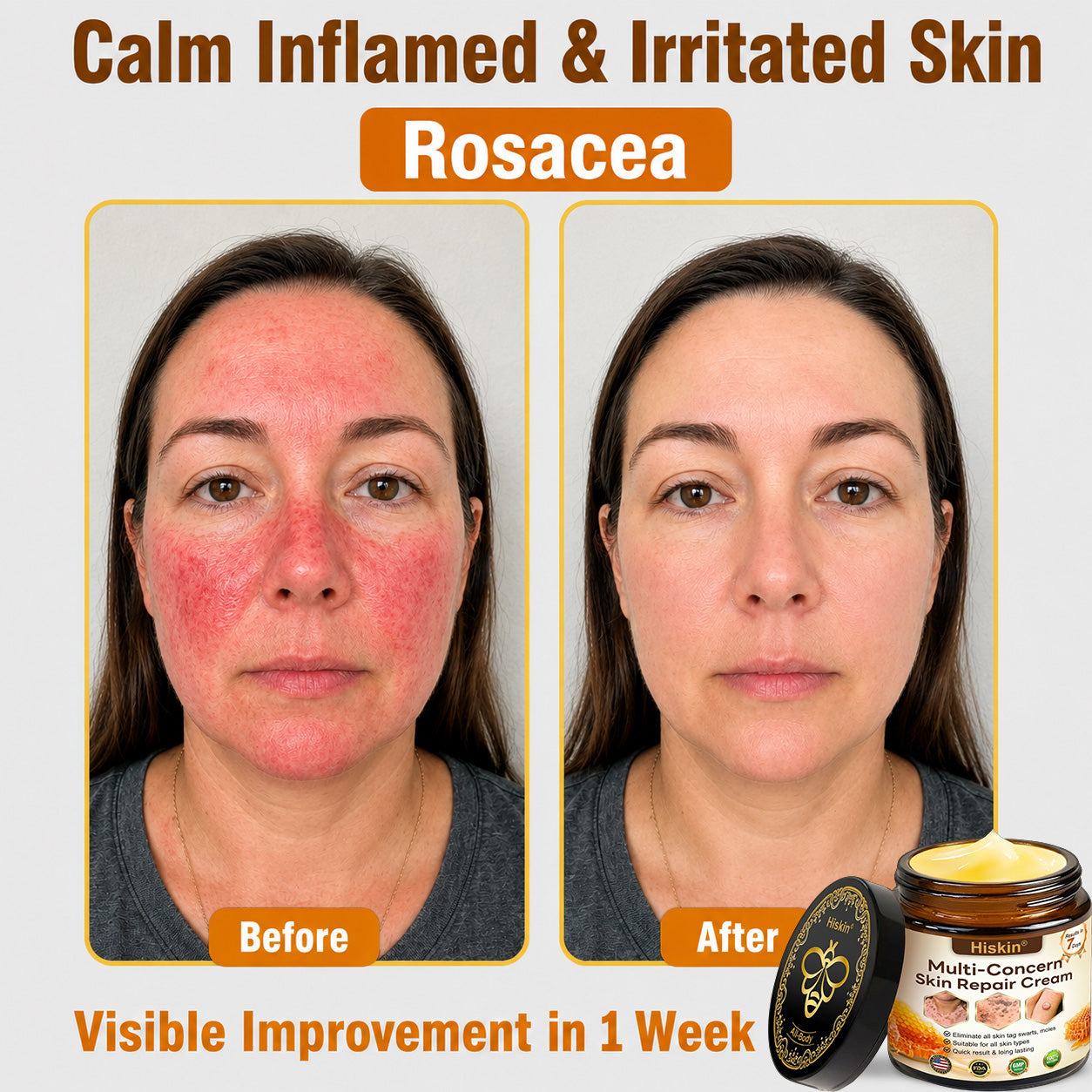 ✨HISKIN® Multi-Concern Skin Repair Cream ✨ (One powerful cream to repair inflammation, dryness, aging, pigmentation, and visible skin damage.)