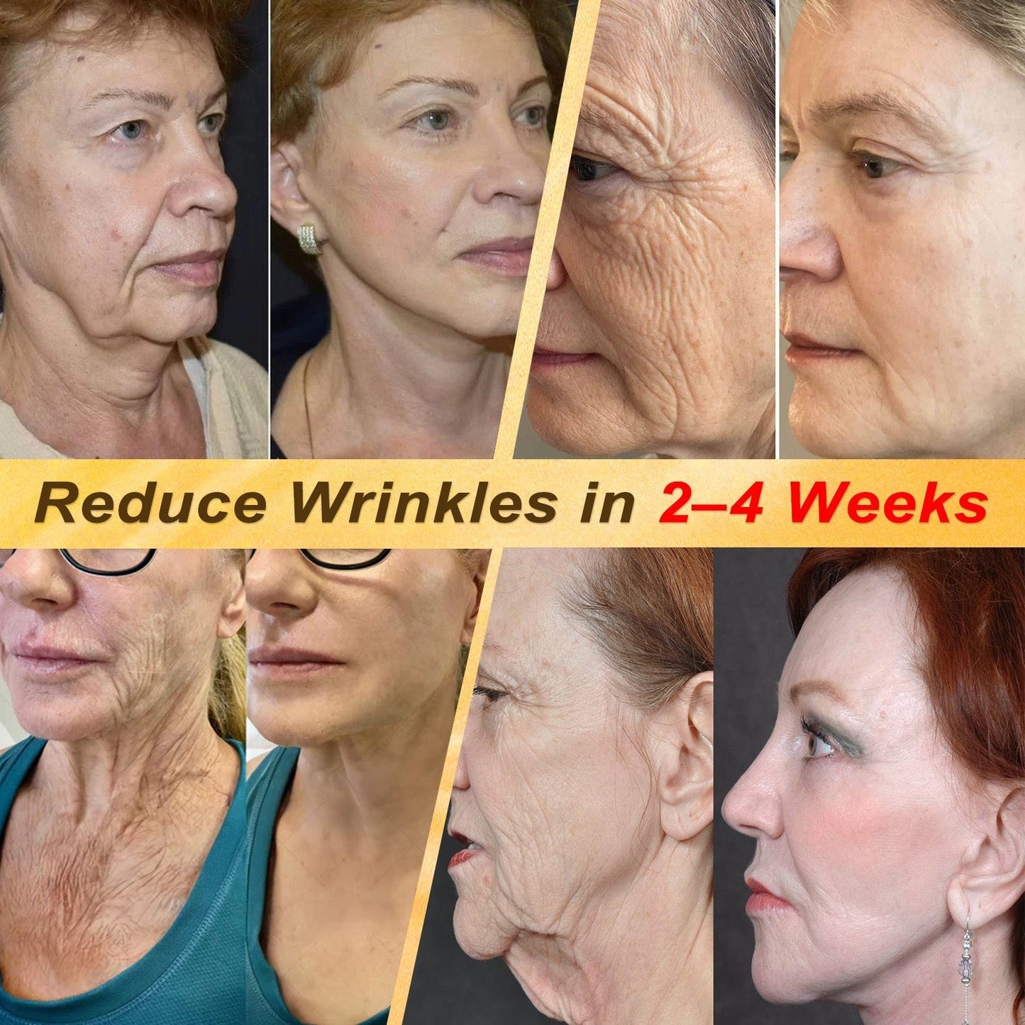 ✨HISKIN® Multi-Concern Skin Repair Cream ✨ (One powerful cream to repair inflammation, dryness, aging, pigmentation, and visible skin damage.)