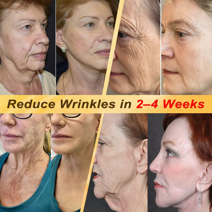 ✨HISKIN® Multi-Concern Skin Repair Cream ✨ (One powerful cream to repair inflammation, dryness, aging, pigmentation, and visible skin damage.)