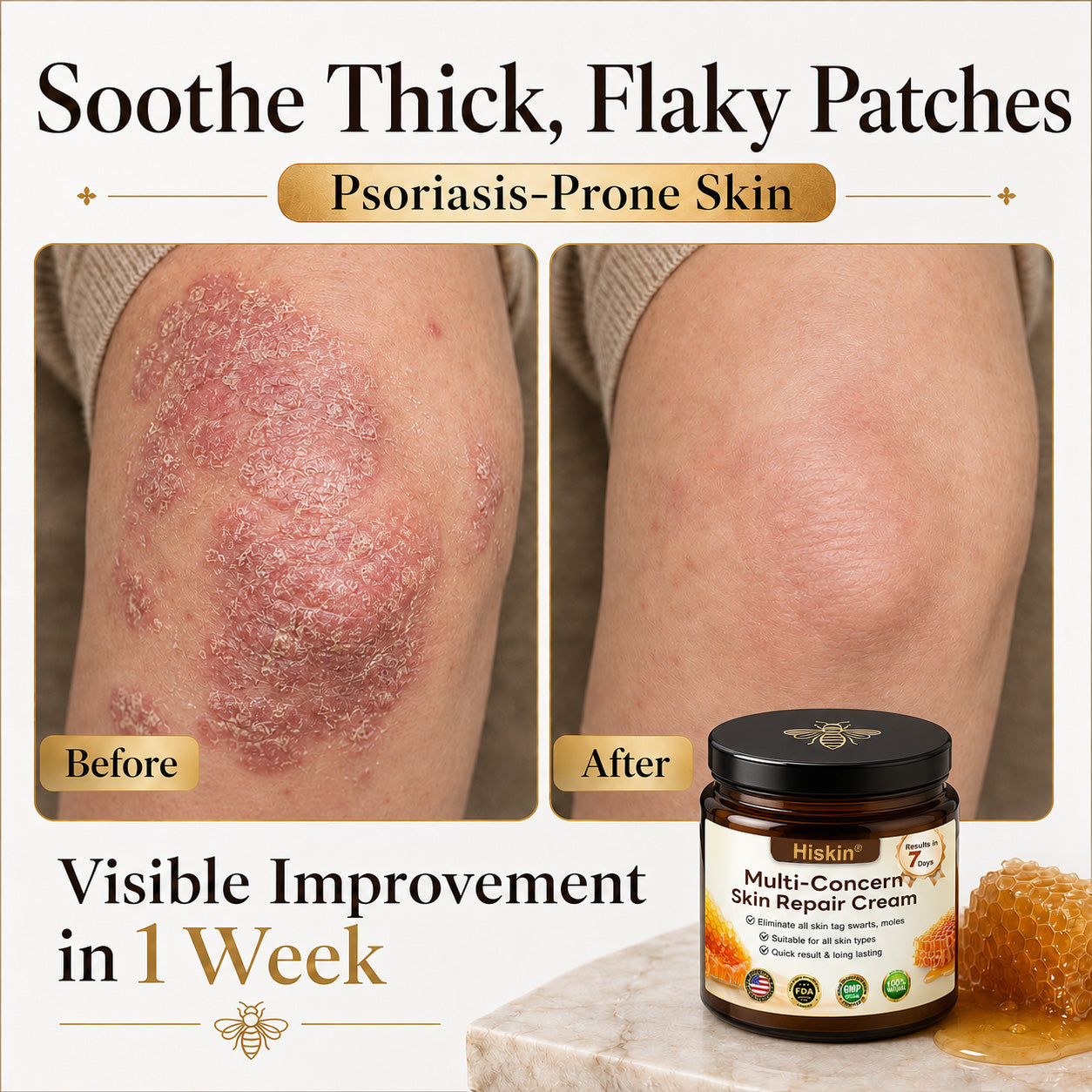 ✨HISKIN® Multi-Concern Skin Repair Cream ✨ (One powerful cream to repair inflammation, dryness, aging, pigmentation, and visible skin damage.)